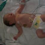 In the NICU after birth