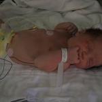 In the NICU after birth