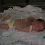 In the NICU after birth