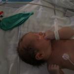 In the NICU after birth