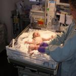 In the NICU after birth, bubble baby