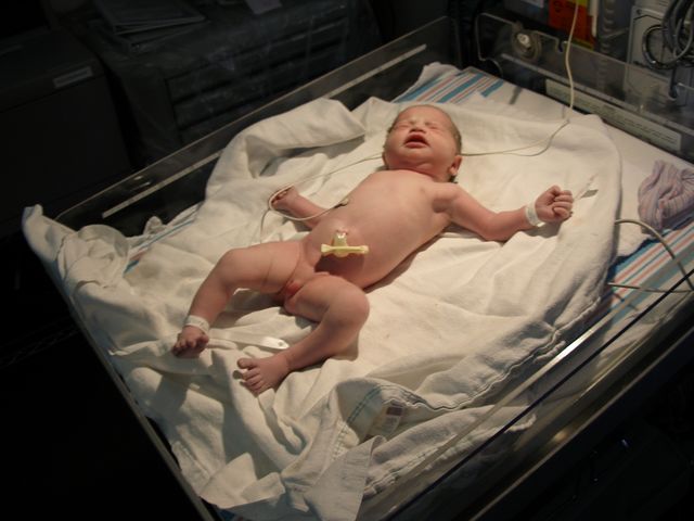 In the NICU after birth