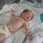 In the NICU after birth