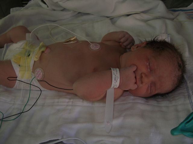 In the NICU after birth