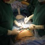 In the OR