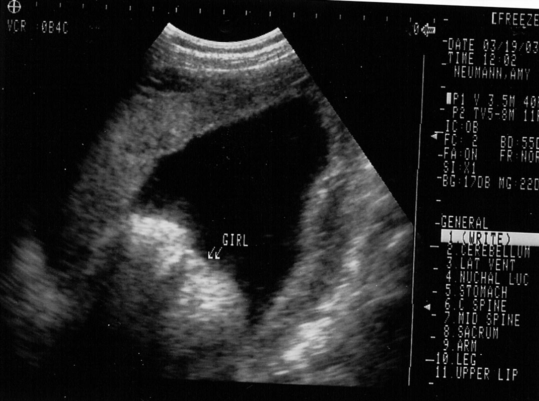 Kaylin's Butt!!!  Yes, that's her butt.... proof it's a girl, nothing in between.