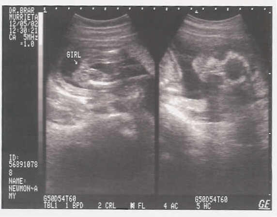 This is proof it's a girl!