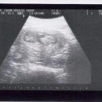 Ultrasound 10/17/02, 12 Weeks
Yes that is a baby!!!!